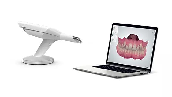 Caméra numérique en orthodontie