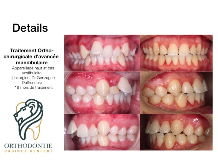 cas clinique n°10