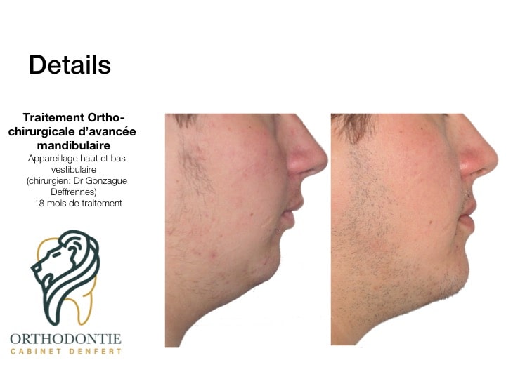 cas clinique n°11