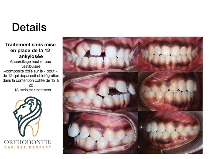 cas clinique n°13