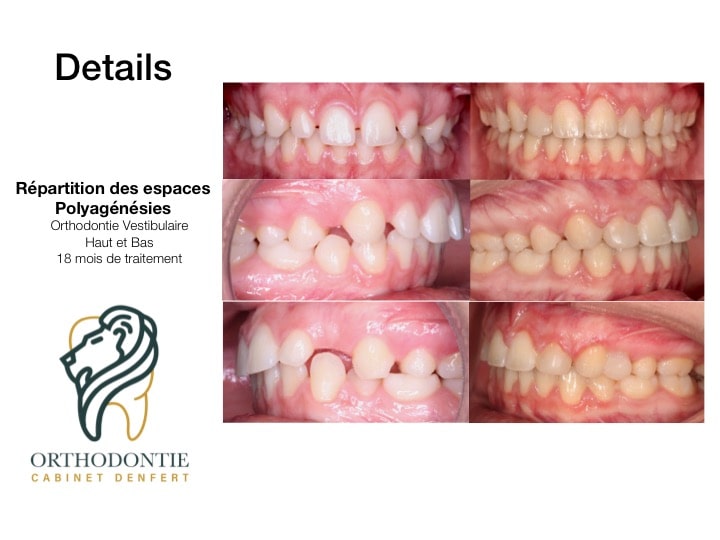 cas clinique n°3