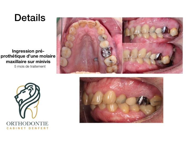 cas clinique n°6