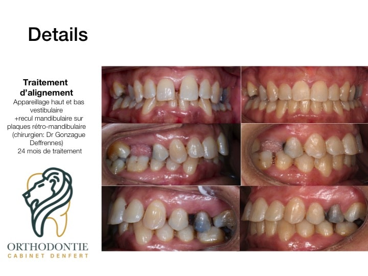 cas clinique n°9